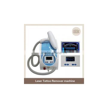 2016 high quality nd yag laser laser tattoo removal q-switch tattoo removal machine