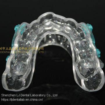 Anti-snoring Device, Dental Sportguard, Occlusal Splint, Laboratoire Dentaire, Dentallabor, Laboratorio Dental, Dental Laboratory, Shenzhen LJ Dental Lab China photo-5