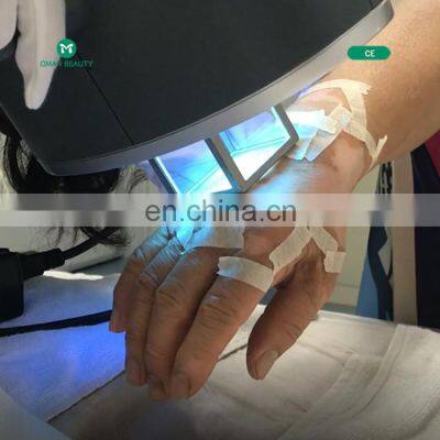 Sales 308nm 310nm uv Led/led 308nm/excimer Laser 308nm Psoriasis Vitiligo Laser uv Lamp photo-3