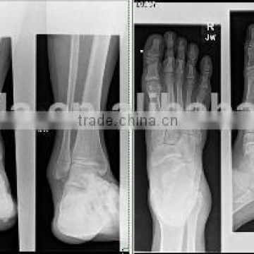 medical x-ray film agfa, fuji dry film for x-ray product development