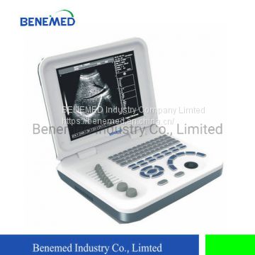 Notebook Type Black and White Ultrasound Scanner Diagnosis Equipment