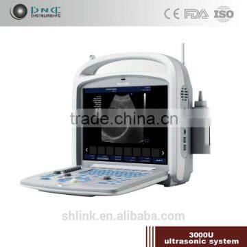 Hospital diagnostic scanner portable ultrasound scanner 3000U