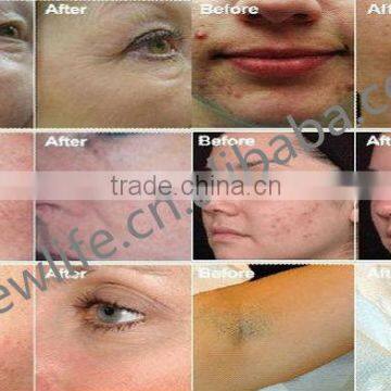 CE Certificated Galvanic BIO Wrinkle Removal Beauty Machine Anti Wrinkle Device for Whitening & Skin Care Facial & Lifting photo-3