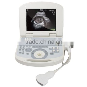 Best selling convex , linear , micro-convex, transvaginal, rectal laptop ultrasound & portable ultrasound scanner