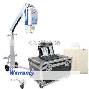 MY-D049R 5.6KW medical radiography system mobile portable x-ray machines digital