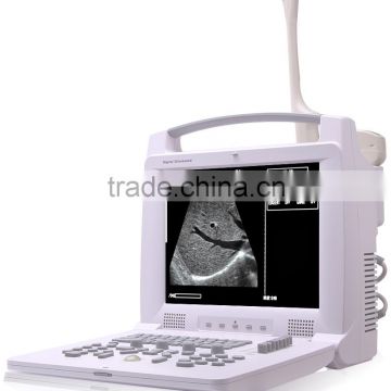 MCB-18A 12.1"LED Screen Full Digital Portable Ultrasound Scanner