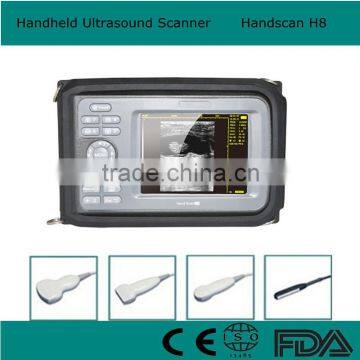 CE*FDA certified Palm Handheld Ultrasound Scanner machine with 3.5 Mhz Convex probe 5.5 inch monitor optional endo-vaginal