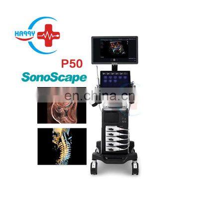 Sonoscape P50 Portable echography color ultrasound device 3D Color doppler ultrasound machine