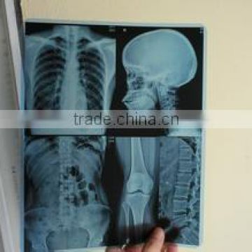 Konida medical laser x-ray film agfa/Dry thermal film