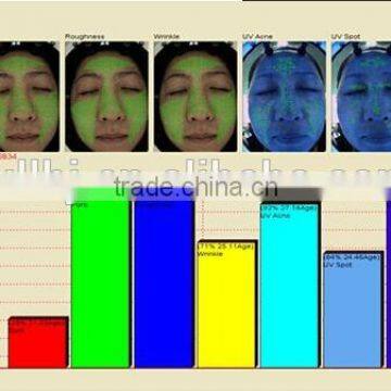 Magic Mirror 3D Skin Analyzer/ Best RGB+PL+UV Skin Analyzer photo-3