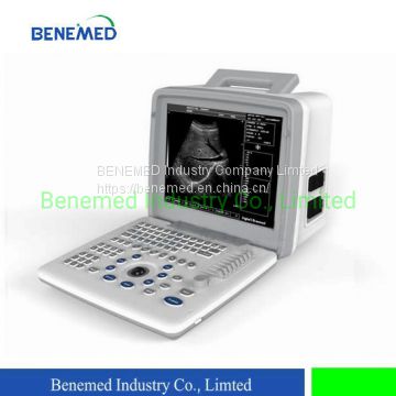 Portable B/W Ultrasound Scanner with Clear Image Quality Hospital Equipment