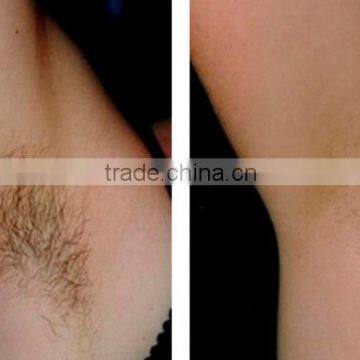 Shr Ipl Laser Hair Removal Machine Price China/shr Ipl Hair Removal Machine for Sale photo-5