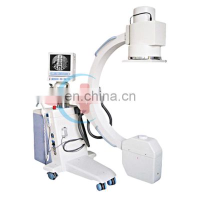 HC-D009 Medical image analog x-ray mobile C-arm x-ray machine