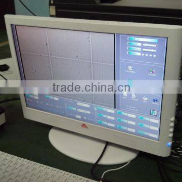 Beautiful Sperm Analysis System Analysis of Sperm Quality photo-4