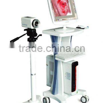 Colposcope 2100I