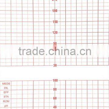 Fetal Monitor Paper / 150mm*100mm-150p Fetal Monitor Recording Paper