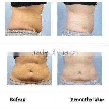 NL-RUV501 Cavitation Slimming Machine/vacuum Drying Machine/tripolar Vacuum Cavitation Machine photo-5