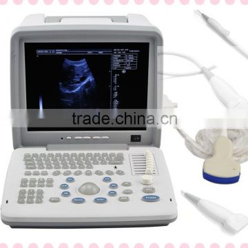 12-inch LCD monitor Portable Ultrasound Scanner with Convex Linear micro-convex probe RUS 9000B