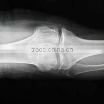 medical products china cr x ray system imaging film thermal ct knd-a/f