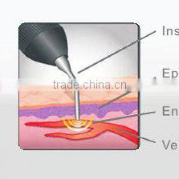 China Hair Salon Equipment Vascular Spider Vein Removal Machine photo-3