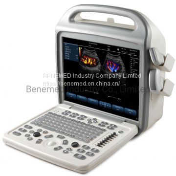 Popular Portable Color Doppler Ultrasound Scanner Bene-3