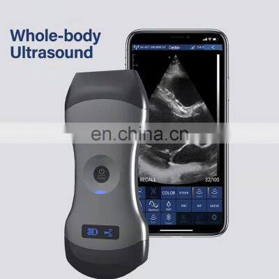CE Certificated Portable 128 Elements 3 In 1 Wireless Ultrasound Machine for Hospital Use