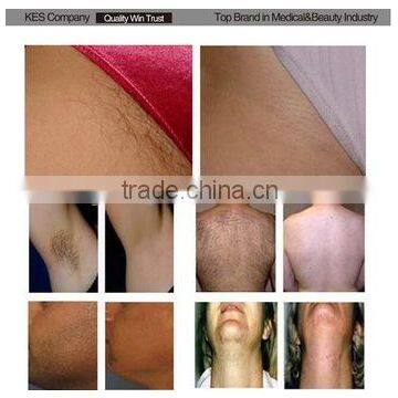 2015 Diode Laser 808nm Permanent Hair Removal Machine 500w Power Supply for Laser photo-6