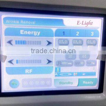 Chest Hair Removal E Light/IPL/OPT/ SHR/ SSR + Bikini Hair Removal RF + Nd Yag Laser 3in 1 Ipl Machina