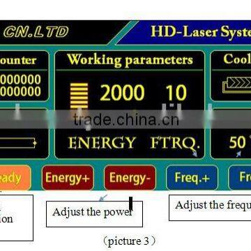 Q Switch Laser Tattoo Removal Big Energy Q-switch Nd Yag 800mj Laser Laser Stretch Mark Removal Machine
