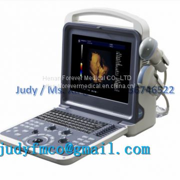 Portable Color Doppler Ultrasound Scanner System