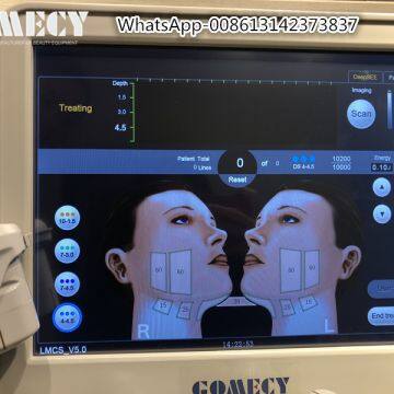 Ulthera HIFU Korean Anti-aging Machine Wrinkle Removal Face Lift Skin Tightening HIFU Body Shaping Cartridge photo-3