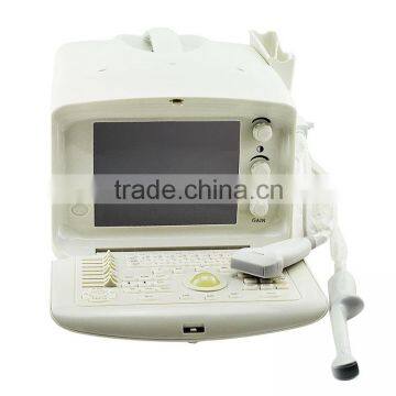 Factory OEM Design Reliable Performance Cheap pc Based Ultrasound Scanner for Human photo-3