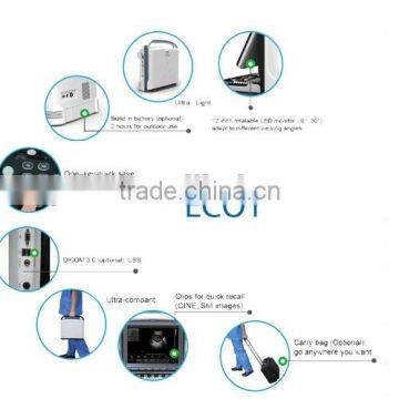 CE Approved Advanced Chison Ultrasound Scanner With 3.5Mhz Multi-frequency Convex Probe ECO1 photo-2