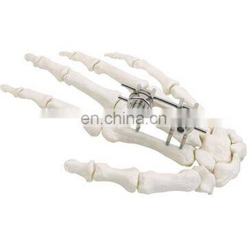 Guaranteed Quality Semi-circular External Fixator Orthopedic Surgical Implant