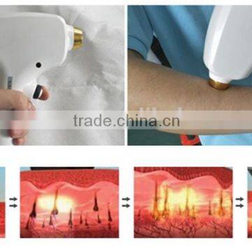 Germany Import Lamp 808nm Diode Laser Hair Removal/ Permanent Hair Removal Machine photo-3