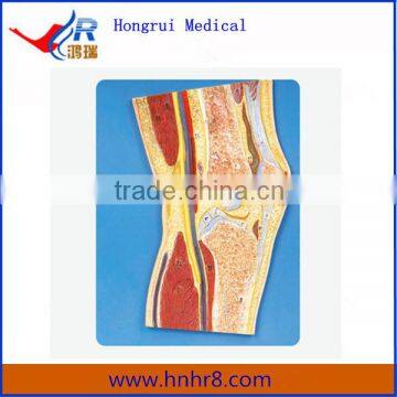 Human Anatomical Knee Joint Section Model for Education