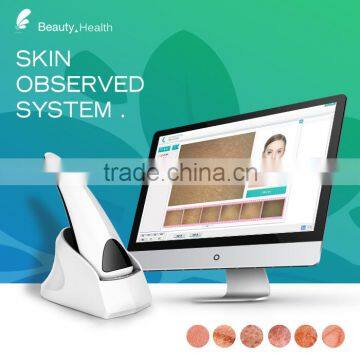 Portable dermatome skin analyzer for skin testing machine