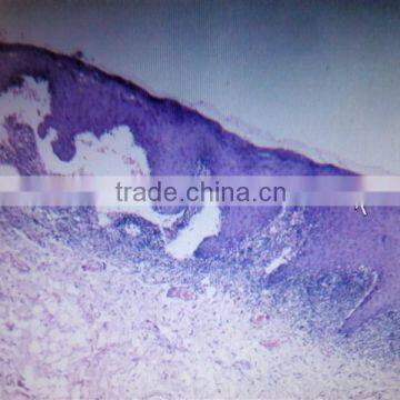 Factory Price Human Histological Oral Slides,pathological Prepared Slides,7101 Microscope Slides photo-5