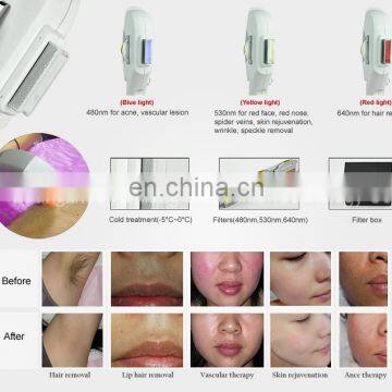 Multifunctional Elight Ipl rf Laser Tattoo Removal+hair Removal Beauty Device for Sale photo-6