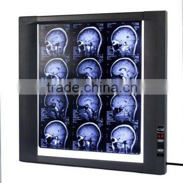 LED cold light medical x-ray film scanner