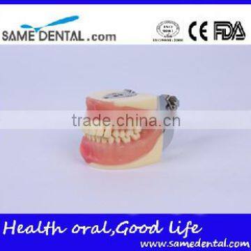 Dental Surgical Integrated Model Teaching Demonstration Teeth Model