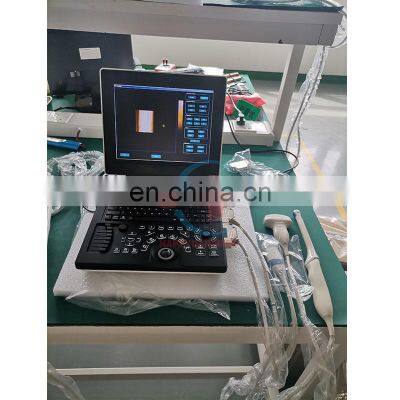 HC-A013C Factory Direct Portable 3D Color Doppler Ultrasound Machine 12 Inch LCD Display Laptop Ultrasound Diagnostic System photo-3