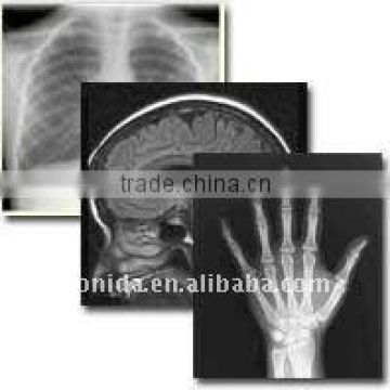 Medical x ray film,dry imaging films