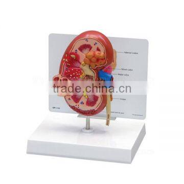 Pathological Medical Human Body Anatomy Model Kidney photo-3