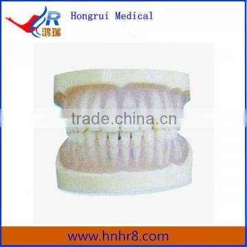 Hot Sale Full Mouth Standard Transparent PE Teeth Model