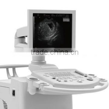 MCB-8500 High definition Black and White Ultrasound Machine