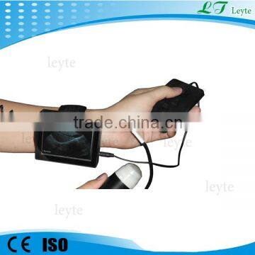 LTV2 Veterinary Wrist diagnostic ultrasound machine