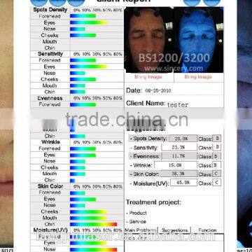 Hot-selling Made in China Smart System Digital Dermatoscope Professional Portable 3d Skin Analyzer