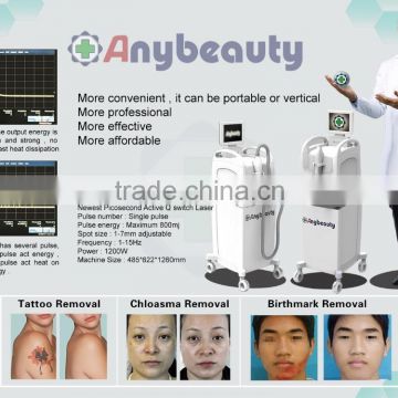 Eyebrow/chloasma Removal Active Q Switch Tattoo Removal Laser Machine Nd Yag Laser Hori Naevus Removal