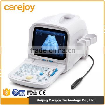 2016 Medical Equipment Cheap ultrasound Machine for Veterinary and Human